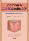 『これでわかるニキビの治療とケア 安易に抗菌薬に頼っていませんか?』